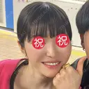 糸リフト / 脂肪吸引（顔） / メーラーファット除去 BLINC CLINIC （ブリンク クリニック） AFTER サムネイル用