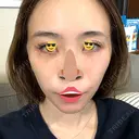 糸リフト / クマ治療 / 肌ヒアルロン酸注入（たるみ・シワ改善） 東京形成美容外科 船橋院 DAY 0 サムネイル用