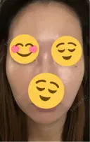 その他（輪郭） ARTE BEAUTY CLINIC DAY 2 サムネイル用