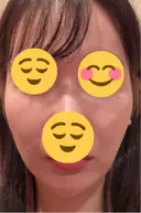 その他（輪郭） ARTE BEAUTY CLINIC DAY 3 サムネイル用