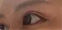 二重切開 オーキッド美容クリニック東京御徒町 DAY 124 サムネイル用