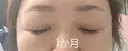 目元修正 / 自然癒着法 LUHO（ルホ）美容外科 DAY 34 サムネイル用