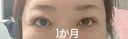 目元修正 / 自然癒着法 LUHO（ルホ）美容外科 DAY 34 サムネイル用