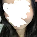 その他（肌） LUNA BEAUTY CLINIC 池袋駅前院 DAY 10 サムネイル用