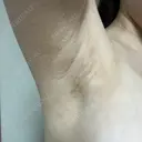 豊胸（シリコンバッグ） / 豊胸（脂肪注入） / 豊胸（シリコン＋脂肪併用） / その他（胸） お茶の水美容形成クリニック DAY 22 サムネイル用