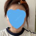 ボトックス（エラ・小顔） TCB東京中央美容外科 自由が丘院 AFTER サムネイル用