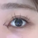 目頭切開 9BeautyClinic DAY 1 サムネイル用