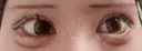 二重切開 / 目頭切開 / 眼瞼下垂（切開） オーキッド美容クリニック東京御徒町 AFTER サムネイル用