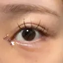 目頭切開 9BeautyClinic DAY 3 サムネイル用
