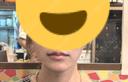 ヒアルロン酸注入（涙袋） / ヒアルロン酸注入（唇） / ボトックス（口角） おおたかの森ビューティークリニック DAY 5 サムネイル用