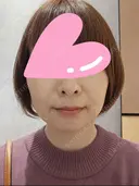 糸リフト / 脂肪吸引（顔） / メーラーファット除去 / ジョールファット除去 / 脂肪吸引注射（顔） ziz CLINIC DAY 34 サムネイル用