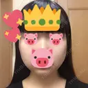 ボトックス（エラ・小顔） / 脂肪溶解注射（顔） 湘南美容クリニック 松戸院 DAY 45 サムネイル用