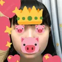 ボトックス（エラ・小顔） / 脂肪溶解注射（顔） 湘南美容クリニック 松戸院 AFTER サムネイル用