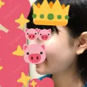 ボトックス（エラ・小顔） / 脂肪溶解注射（顔） 湘南美容クリニック 松戸院 DAY 153 サムネイル用