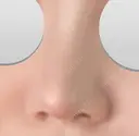 隆鼻術 / 鼻尖形成（切開） / 小鼻縮小（切開） / その他（鼻） / 軟骨移植 / 鼻尖縮小 / 鼻翼基部形成（貴族手術） / 鼻柱下降・鼻唇角形成（猫手術） 東京シンデレラ美容外科 池袋院 DAY 12 サムネイル用