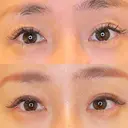 目尻切開 / タレ目形成・グラマラスライン（埋没） LOUIS CLINIC 二子玉川院【ルイクリニック】 AFTER サムネイル用