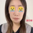セットバック 大塚美容形成外科・歯科 大塚本院 DAY 277 サムネイル用