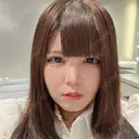 二重埋没 / ヒアルロン酸注入（涙袋） / ヒアルロン酸注入（あご） R Beauty CLINIC 名古屋院 AFTER サムネイル用