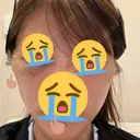 切開リフト 東京エビスクリニック DAY 19 サムネイル用