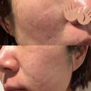 ポテンツァ CZEN CLINIC 銀座院 DAY 1 サムネイル用