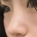 小鼻縮小（切開） / 鼻尖形成（非切開） ASTRA BEAUTY CLINIC DAY 754 サムネイル用