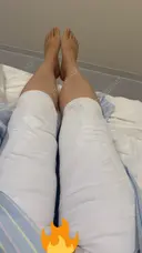 脂肪吸引（脚） アムルーズ美容外科クリニック 横浜院 DAY 0 サムネイル用