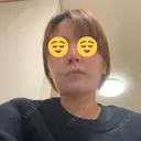 ダーマペン 美容皮膚科 デュークリニック AFTER サムネイル用