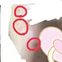 ほくろ・いぼ切除（肌） 赤坂メディカルMクリニック AFTER サムネイル用