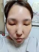 白玉点滴・注射 城本クリニック 横浜院 DAY 0 サムネイル用