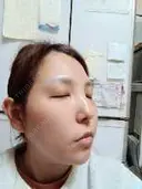 白玉点滴・注射 城本クリニック 横浜院 DAY 3 サムネイル用