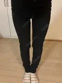 医療痩身（太もも） / 脂肪冷却（太もも） DSクリニック 新宿院 DAY 13 サムネイル用