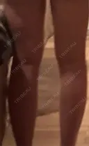 医療痩身（太もも） / 脂肪冷却（太もも） DSクリニック 新宿院 DAY 32 サムネイル用