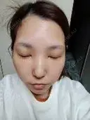 白玉点滴・注射 城本クリニック 横浜院 AFTER サムネイル用