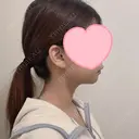 糸リフト / 脂肪吸引（顔） EMMA CLINIC（エマクリニック） DAY 7 サムネイル用