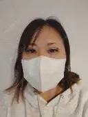 二重埋没 THE FIRST CLINIC 多摩センター院 AFTER サムネイル用