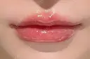 ヒアルロン酸注入（唇） X CLINIC 恵比寿院 AFTER サムネイル用