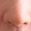鼻尖形成（切開） / 軟骨移植 / 鼻孔縁下降 / 鼻柱下降・鼻唇角形成（猫手術） もとび美容外科クリニック 新宿院 DAY 7 サムネイル用