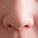 鼻尖形成（切開） / 軟骨移植 / 鼻孔縁下降 / 鼻柱下降・鼻唇角形成（猫手術） もとび美容外科クリニック 新宿院 DAY 10 サムネイル用