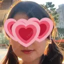 骨切り（あご） / 骨削り（エラ） / ルフォー+ssro（両あご) リラ・クラニオフェイシャル・クリニック AFTER サムネイル用