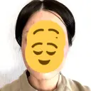 ボトックス（エラ・小顔） TCB東京中央美容外科 梅田茶屋町院 AFTER サムネイル用