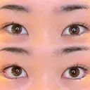 目尻切開 / タレ目形成・グラマラスライン（埋没） LOUIS CLINIC 二子玉川院【ルイクリニック】 DAY 0 サムネイル用