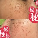 ルメッカ MIO CLINIC 梅田院 DAY 3 サムネイル用