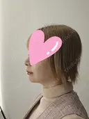 糸リフト / 脂肪吸引（顔） / メーラーファット除去 / ジョールファット除去 / 脂肪吸引注射（顔） ziz CLINIC DAY 97 サムネイル用