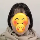 骨削り（エラ） / 脂肪吸引（顔） id（アイディ）美容外科 AFTER サムネイル用