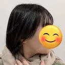 骨削り（エラ） / 脂肪吸引（顔） id（アイディ）美容外科 DAY 366 サムネイル用