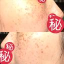 ルメッカ MIO CLINIC 梅田院 DAY 6 サムネイル用