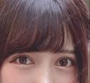 二重切開 / 眼瞼下垂（切開） / 目尻切開 / タレ目形成・グラマラスライン（切開） / ヒアルロン酸注入（涙袋） ジュエリー美容外科 DAY 13 サムネイル用