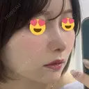 隆鼻術 / 鼻尖形成（切開） / 鼻中隔延長（切開） / 軟骨移植 / 鼻修正 / 鼻尖縮小 / 真皮移植 / 小鼻縮小（非切開） 銀座マイアミ美容外科 DAY 12 サムネイル用