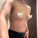 豊胸（脂肪注入） 銀座マイアミ美容外科 DAY 7 サムネイル用