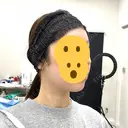 RF（高周波）たるみ治療 MEMOTO CLINIC 名古屋 DAY 4 サムネイル用